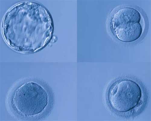 如何确定排卵期？备孕女宝宝应该注意什么？